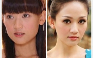 整容前后对照图片大全，整容前后对照图片大全女